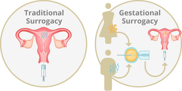 Diagram of traditional surrogacy vs gestational surrogacy